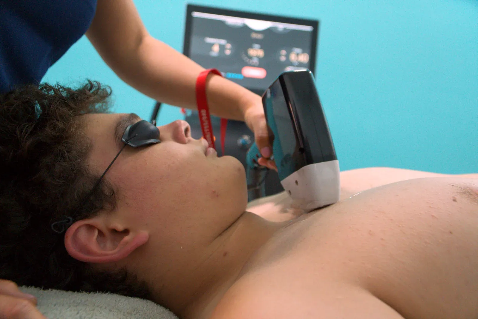 Depilación láser en el cuello, con gafas de protección